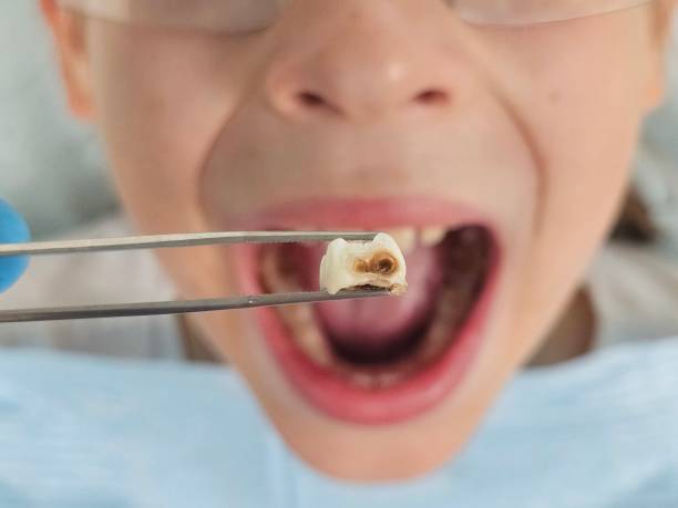 Best Walk-In Emergency Dental Services in Naples, TX